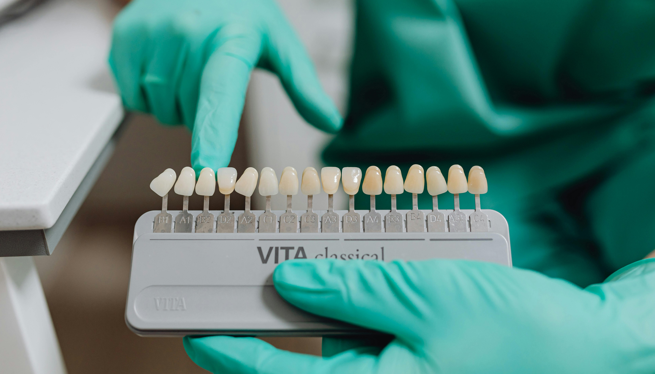 Composite Bonding and Direct Composite Veneers 2 banner